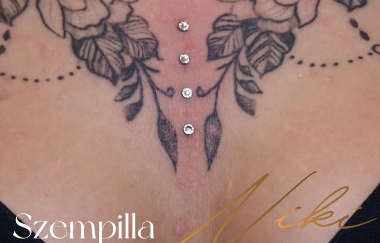 Virág formájú microdermal