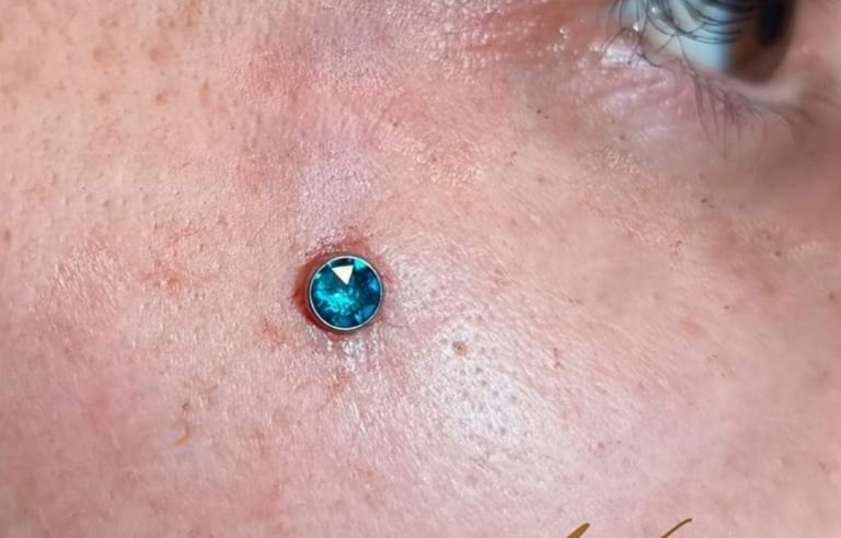 Microdermal hópehely formájú